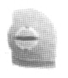 Dispositif de plombage Weber ABT-R